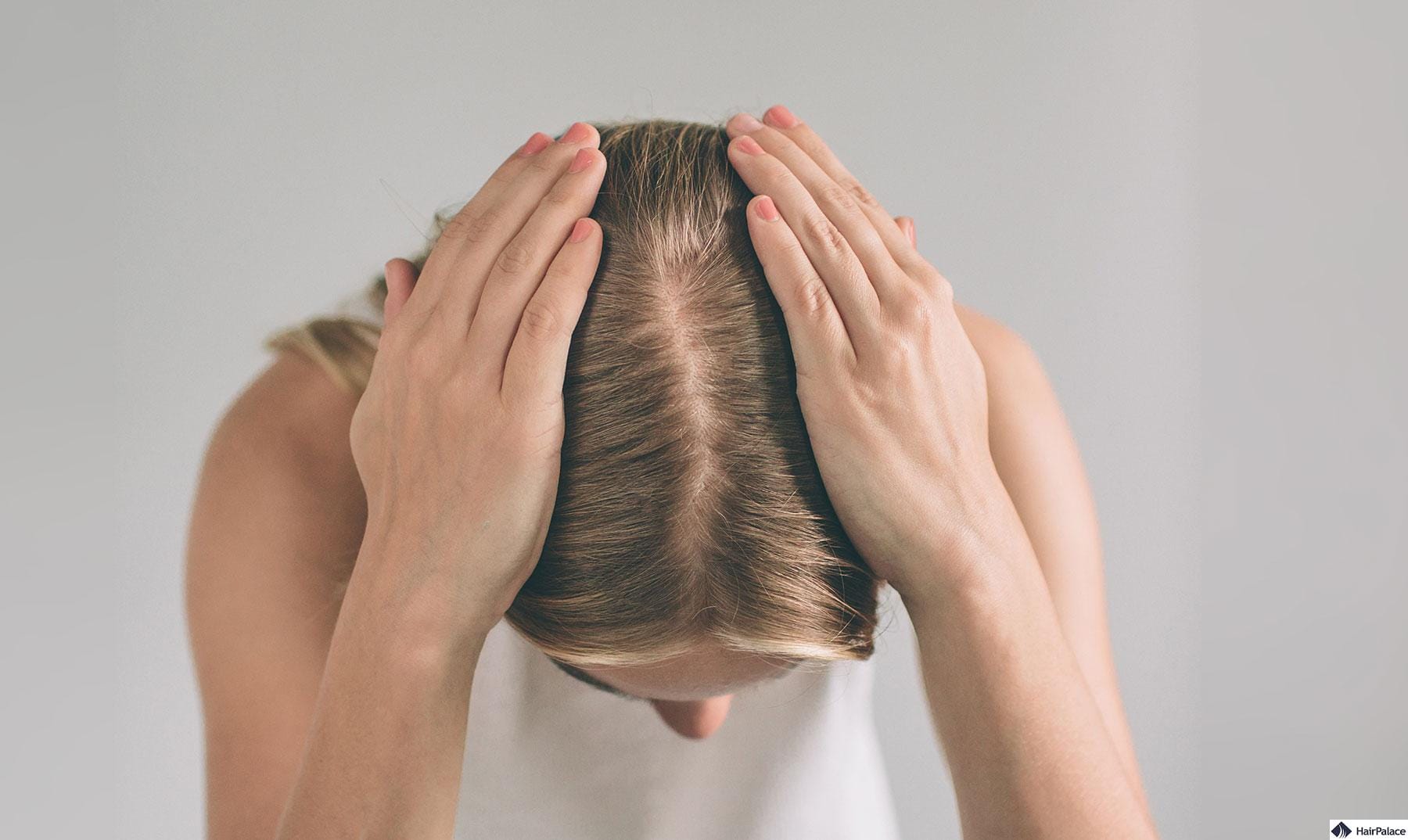 Affordable Hair Transplant London – Trusted UK Specialists