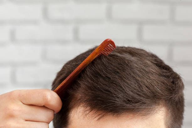 Hair Transplant Price in Turkey: Why It’s So Affordable