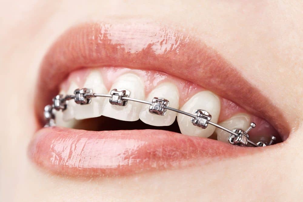 Your Guide to the Best Dental Clinic in Chennai for Exceptional Care